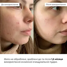 Ензимна очищувальна пудра Hillary Enzyme Balance Cleanser Powder для жирної та комбінованої шкіри 40 г - мініатюра 9