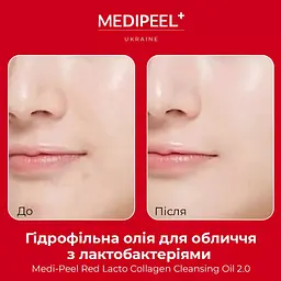 Гідрофільна олія для обличчя з лактобактеріями MediPeel Red Lacto Collagen Cleansing Oil 2.0 200 мл - мініатюра 6