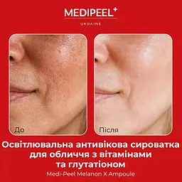 Сироватка для обличчя Medi-Peel Melanon X Ampoule  з вітамінами та глутатіоном освітлювальна 50 мл - мініатюра 4