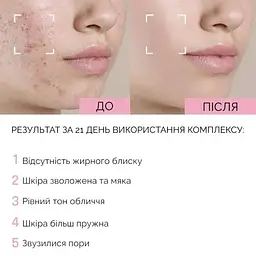 Відновлююча сироватка для обличчя з ніацинамідом та гіалуроновою кислотою Reclaire cosmetics 30 мл - мініатюра 4