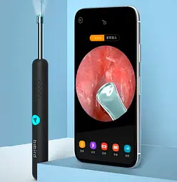Розумна вушна паличка Xiaomi Bebird R1 Smart Visual Ear Cleaner (White) [66150] - мініатюра 3