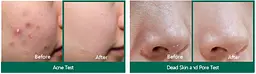 Крем для обличчя Some By Mi AHA-BHA-PHA 30 Days Miracle Cream відновлювальний з комплексом кислот 60 мл - мініатюра 3