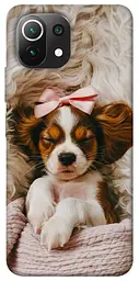 TPU чохол Demsky Sleepy spaniel для Xiaomi Mi 11 Lite
