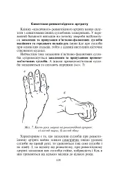 Біль в руках. Отерплість рук. Що потрібно знати про своє захворювання. - Павло Євдокименко - мініатюра 4