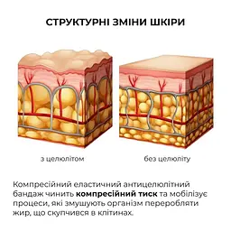 Уцінка. Набір антицелюлітних розігрівальних обгортань Hillary Heating Anti-Cellulite Wrap Set  - мініатюра 3