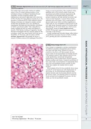 Wheater's Basic Pathology: A Text, Atlas, and Review of Histopathology. International Edition, 5th Edition - Вільям Стюарт - миниатюра 10