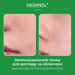 Тонер для обличчя  Medi-Peel Algo-Tox Calming Moisture Toner зволожувальний 250 мл - мініатюра 4