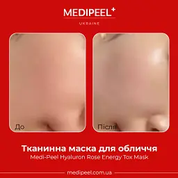 Тканинна маска-детокс Medi-Peel Hyaluron Rose Energy Tox Ampoule Mask з екстрактом троянди 30 мл - мініатюра 2