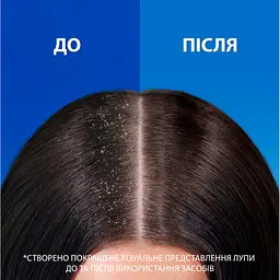 Шампунь Head & Shoulders Pro-Expert 7 Інтенсивний порятунок 250 мл (8700216156844) - мініатюра 3