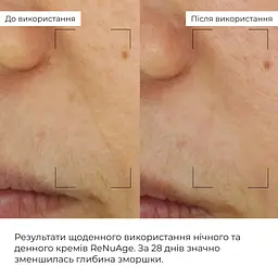 Набір колагеностимулюючих антивікових кремів Колаген- Hillary - мініатюра 9