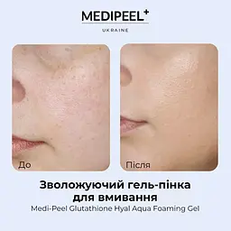 Гель-пінка для вмивання Medi-Peel Glutathione Hyal Aqua Foaming Gel Cleanser зволожувальний 150 мл - мініатюра 5