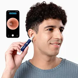 Прилад для видалення вушної сірки (отоскоп) Xiaomi Bebird EarSight Plus (D39R) Blue - мініатюра 8