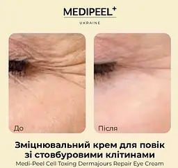 Крем для повік Medi-Peel Cell Toxing Dermajours Repair Eye Cream зміцнювальний зі стовбуровими клітинами 30 мл - мініатюра 4