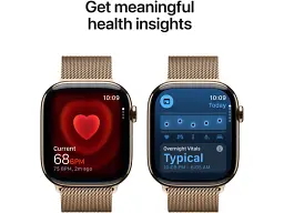 Смарт-годинник Apple Watch Series 11 GPS + Cellular 42mm Gold Tit. Case w. Gold Milanese Loop (MF8Y4) - мініатюра 4