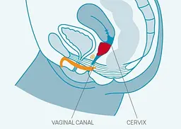 Fun Factory Menstrual Cup-менструальна чаша Розмір B, 30 мл 5.8х4.3 см (сливовий) - мініатюра 3