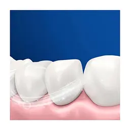Електрична зубна щітка Oral-B Vitality D103.413.3 Protect x clean (4210201427124) - мініатюра 7