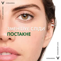 Сироватка-пілінг Vichy Normaderm Probio для корекції недоліків жирної та проблемної шкіри обличчя 30 мл (MB447600) - мініатюра 6