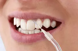 Іригатор Sencor SOI 1310BL (7267243) - мініатюра 6