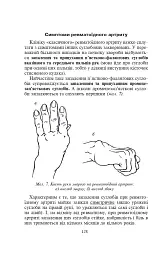 Біль в руках. Отерплість рук. Що потрібно знати про своє захворювання. - мініатюра 4