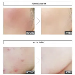 Заспокійливий крем Sur.Medic+ Azulene Soothing Cream 50 мл (SMC004) - мініатюра 5