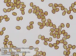 Мікроскоп Bresser Trino Researcher 40x-1000x (5723100) - мініатюра 9