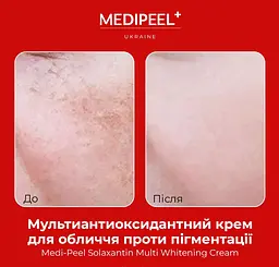 Крем для обличчя Medi-Peel Solaxantin Multi Whitening Cream мультиантиоксидантний проти пігментації 50 г - мініатюра 4