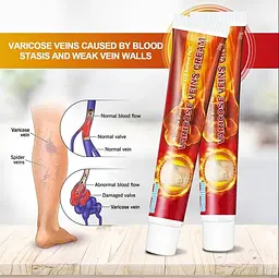 Крем від варикозу Sumifun Varicose Veins Cream 20 г - мініатюра 3
