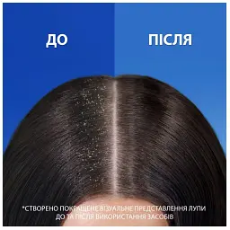 Шампунь проти лупи та бальзам-ополіскувач Head & Shoulders Основний Догляд 2 в 1 360 мл - мініатюра 4