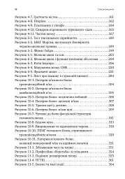 Перемогти контузію. Зцілення від симптомів ЧМТ за допомогою нейрофідбеку та без ліків - мініатюра 7