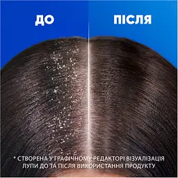 Шампунь Head & Shoulders 2 в 1 Проти лупи Основний догляд 625 мл (8700216304948) - мініатюра 6