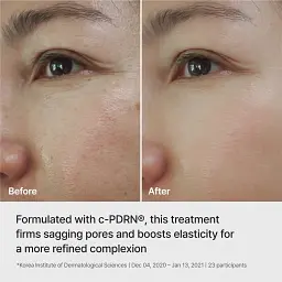 Ампульна ліфтинг-маска Rejuran Ampoule Infused Lifting Mask 28 г - мініатюра 2