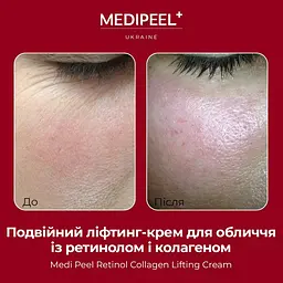 Уцінка. Подвійний ліфтинг-крем Medi-Peel Retinol Collagen Lifting Cream з ретинолом і колагеном 50 мл - мініатюра 4