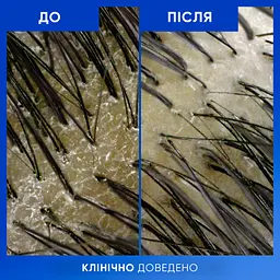 Шампунь Head & Shoulders Clarify & Shine Проти лупи Очищення та блиск 400 мл (8700216658461) - мініатюра 7
