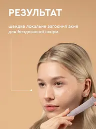 Сироватка антиакне для проблемної шкіри обличчя Serum Active White Mandarin 15 мл Choice - мініатюра 5