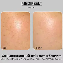 Антивіковий сонцезахисний стік для обличчя Medi Peel Red Peptide 9 Vitanol Sun Stick Pro SPF50+ PA++++ 23 г (MDP190) - мініатюра 6