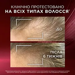 Сироватка для волосся L'Oreal Paris Elseve Full Resist Anti hair-fall Arginine + Aminexil 102 мл - мініатюра 7