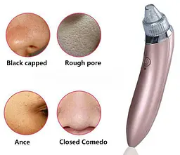 Вакуумний апарат для чищення пор обличчя Menqshahayd XN-8030 Pink (kz048-hbr) - мініатюра 7