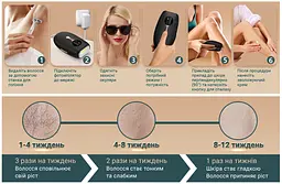Фотоепілятор AIMED Silk Skin PRO Ice Cooling IPL Intensed Pulse Light колір чорний - мініатюра 6