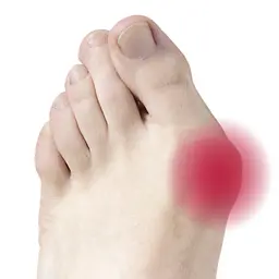 Гелевий протектор на великий палець Vitamed 5th Toe Gel Bunion Pad (F-00042-09-2637) - мініатюра 3