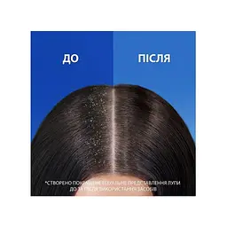 Шампунь Head & Shoulders 2 в 1 Проти лупи Гладеньке та шовковисте 330 мл (8700216304856) - мініатюра 3