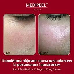 Подвійний ліфтинг-крем Medi-Peel Retinol Collagen Lifting Cream з ретинолом і колагеном 50 мл - мініатюра 4