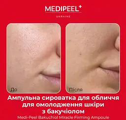 Сироватка для обличчя Medi-Peel Bakuchiol Miracle Firming Ampoule зміцнювальна з бакучиолом  30 мл - мініатюра 4