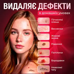 Електрокоагулятор плазмовий для видалення папілом/бородавок Brillix Point Mole Grey - мініатюра 2