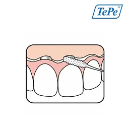 Зубна нитка TePe Bridge & Implant (суперфлос), 30 шт - мініатюра 5