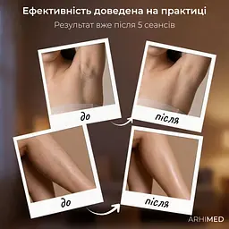 Фотоепілятор ArhiMED IPL Pro - мініатюра 8