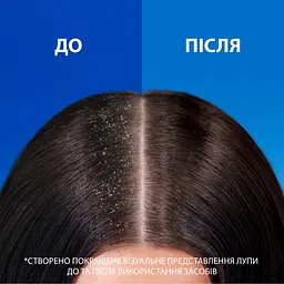 Шампунь Head & Shoulders Pro-Expert 7 Захист від випадіння волосся З кофеїном 250 мл (8700216156936) - мініатюра 6