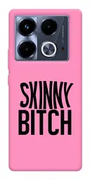 Чохол Demsky Skinny для Infinix Note 40 4G