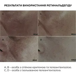 Нічна інтенсивна сироватка з ретиналем Night Intense Retinal Serum Hillary 30 мл - мініатюра 5