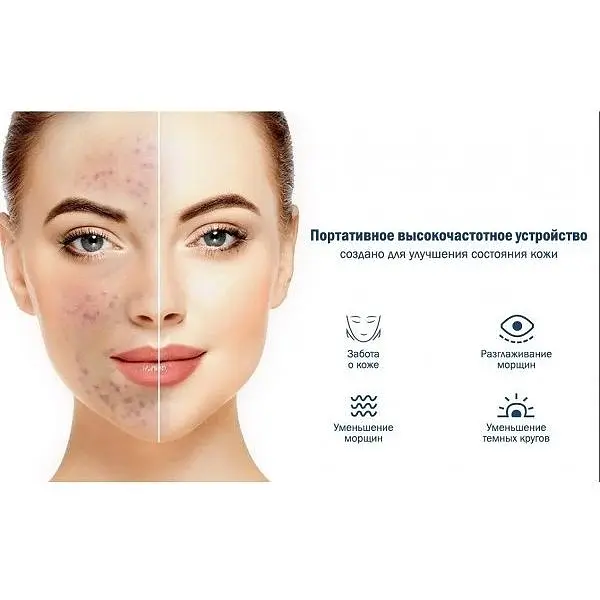 Портативный дарсонваль Medica+ Darsoline 4.0  - фото 6