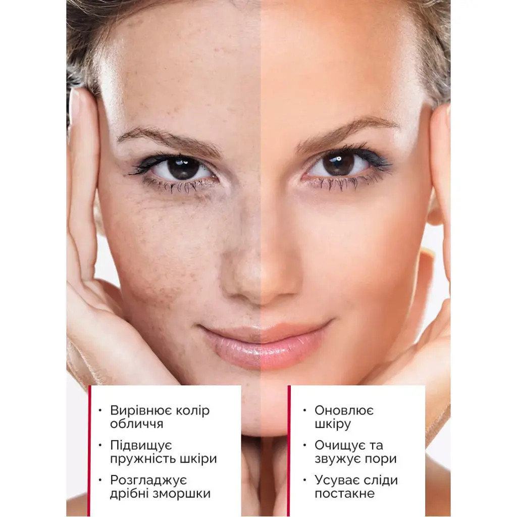 Кислотний пілінг для обличчя AHA 30%+BHA 1% Reclaire cosmetics 30 мл - фото 5